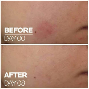 La Roche Posay Cicaplast B5 Увлажняющая сыворотка для лица с центеллой азиатской и витамином B5 30 мл