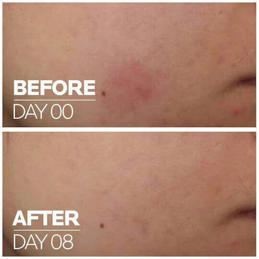 La Roche Posay Cicaplast B5 Увлажняющая сыворотка для лица с центеллой азиатской и витамином B5 30 мл: цены и характеристики