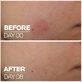 La Roche Posay Cicaplast B5 Увлажняющая сыворотка для лица с центеллой азиатской и витамином B5 30 мл