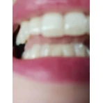 Sensodyne Sensitivity & Gum Зубная паста для чувствительных зубов 75 мл: цены и характеристики
