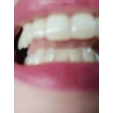 Зубна паста Sensodyne Sensitivity & Gum для чутливих зубів 75мл