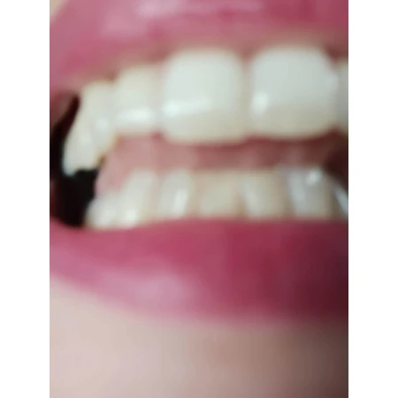 Sensodyne Sensitivity & Gum Зубная паста для чувствительных зубов 75 мл: цены и характеристики