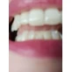 Sensodyne Sensitivity & Gum Зубная паста для чувствительных зубов 75 мл