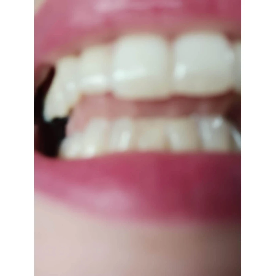 Sensodyne Sensitivity & Gum Зубная паста для чувствительных зубов 75 мл: цены и характеристики
