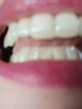 Sensodyne Sensitivity & Gum Зубная паста для чувствительных зубов 75 мл