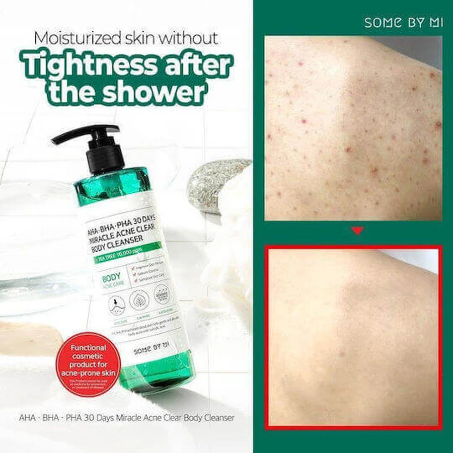 Some By Mi 30 DAYS MIRACLE Гель для тела 400 гр.: цены и характеристики