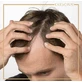 Labo Caducrex Transdermic Caducrex Transdermic HFSC Complete Μan 200 Hair Ампула від випадіння волосся для чоловіків 20х3,5мл