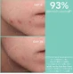 Apivita Just Bee Clear Face & Eye Lotion для кожи, склонной к акне 200 мл