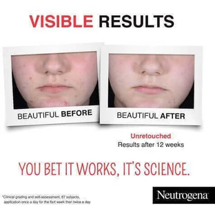 Сыворотка для лица Neutrogena Clear & Defend+ с AHA и салициловой кислотой для сияния 30 мл