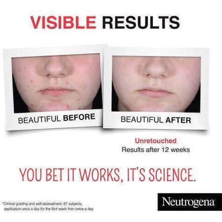 Сыворотка для лица Neutrogena Clear & Defend+ с AHA и салициловой кислотой для сияния 30 мл: цены и характеристики