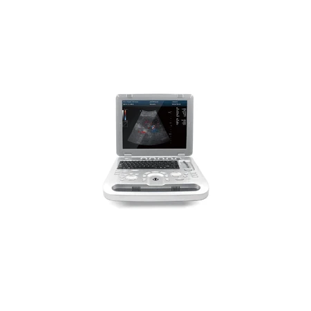 Ультразвуковой сканер Contec CMS1700B: цены и характеристики