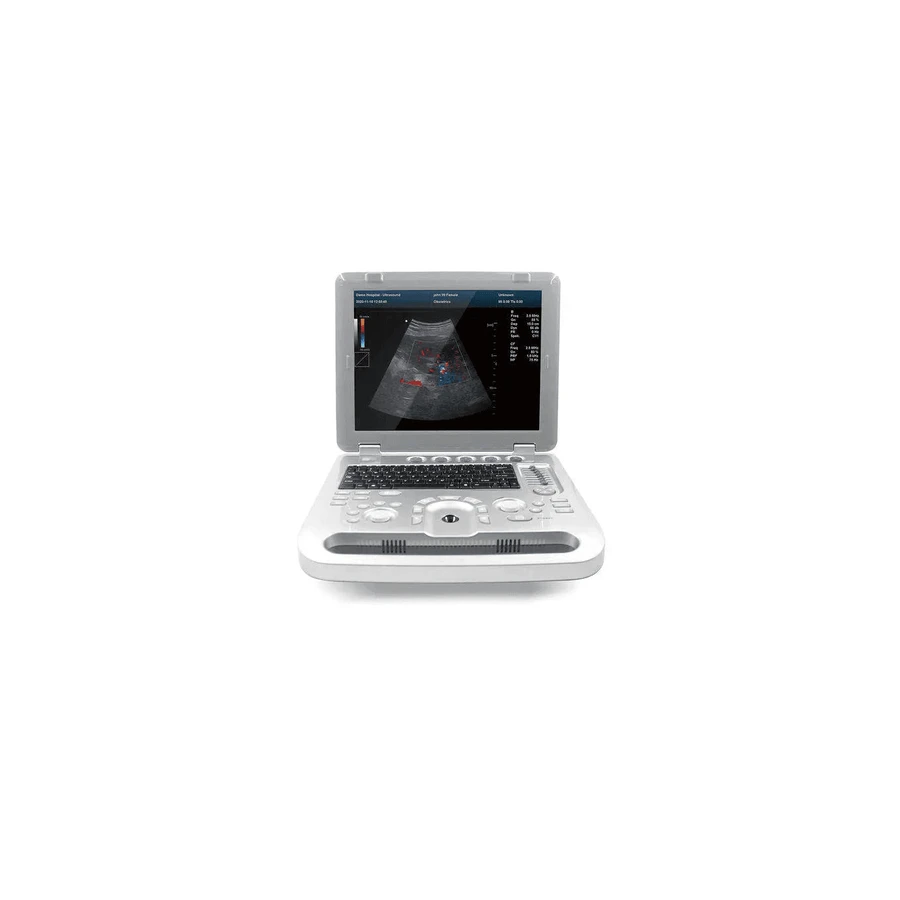 Ультразвуковой сканер Contec CMS1700B: цены и характеристики