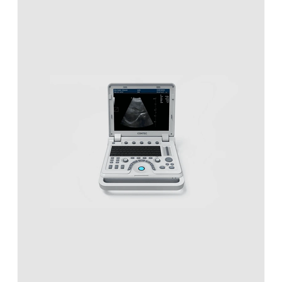 Ультразвуковой сканер Contec CMS600P2 Plus: цены и характеристики